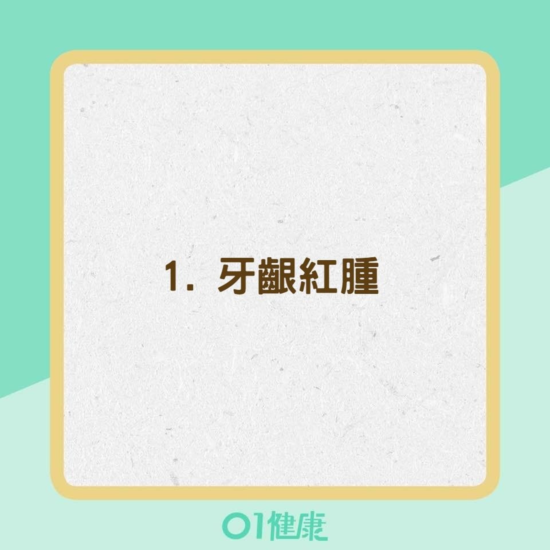 牙周病症狀(01製圖) 牙周病症狀(01製圖)