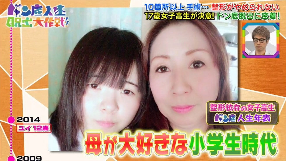 因母親一句太肥太醜日本15歲少女250萬円整容媽哽咽說誤會了 香港01 開罐