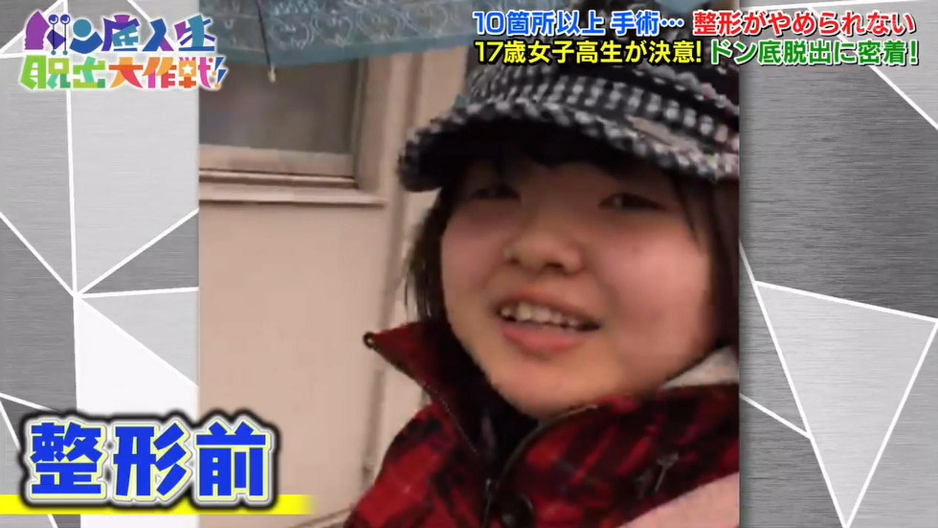 Yui整容前的樣子(節目截圖) Yui整容前的樣子(節目截圖)