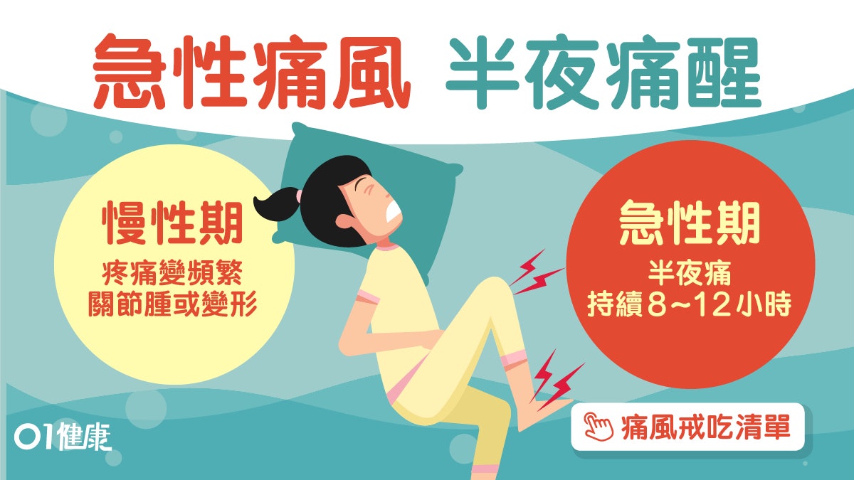 【痛風】半夜腳趾公痛到醒痛風先兆!4個超簡單方法避免尿酸過高 【痛風】半夜腳趾公痛到醒痛風先兆!4個超簡單方法避免尿酸過高