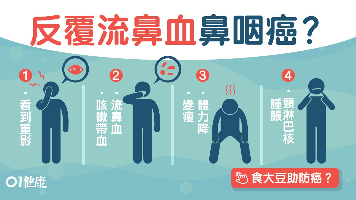 鼻咽癌症狀 檢查 治療及預防方法導演陳木勝因鼻咽癌病逝 鼻咽癌症狀 檢查 治療及預防方法導演陳木勝因鼻咽癌病逝