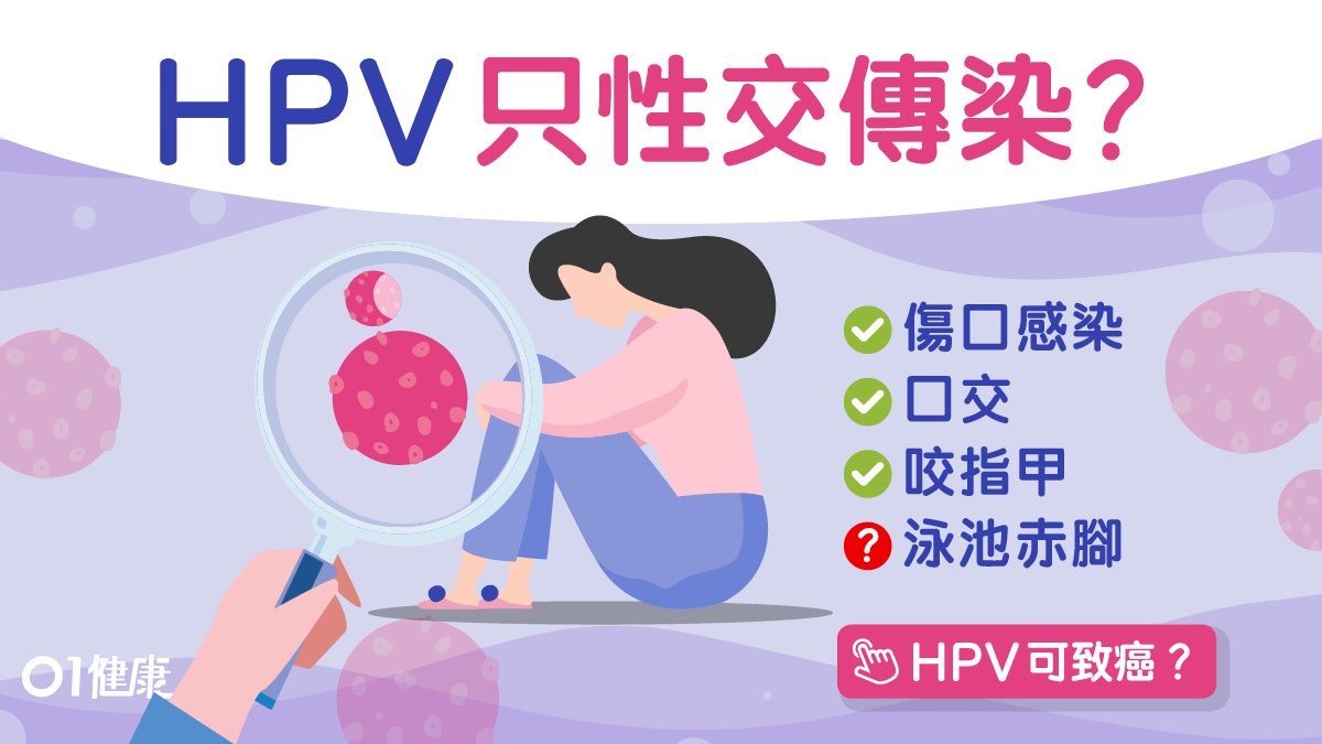 【HPV】性交肌膚接觸也中招 HPV病毒3大真相引發癌症潛伏幾十年! 【HPV】性交肌膚接觸也中招 HPV病毒3大真相引發癌症潛伏幾十年!