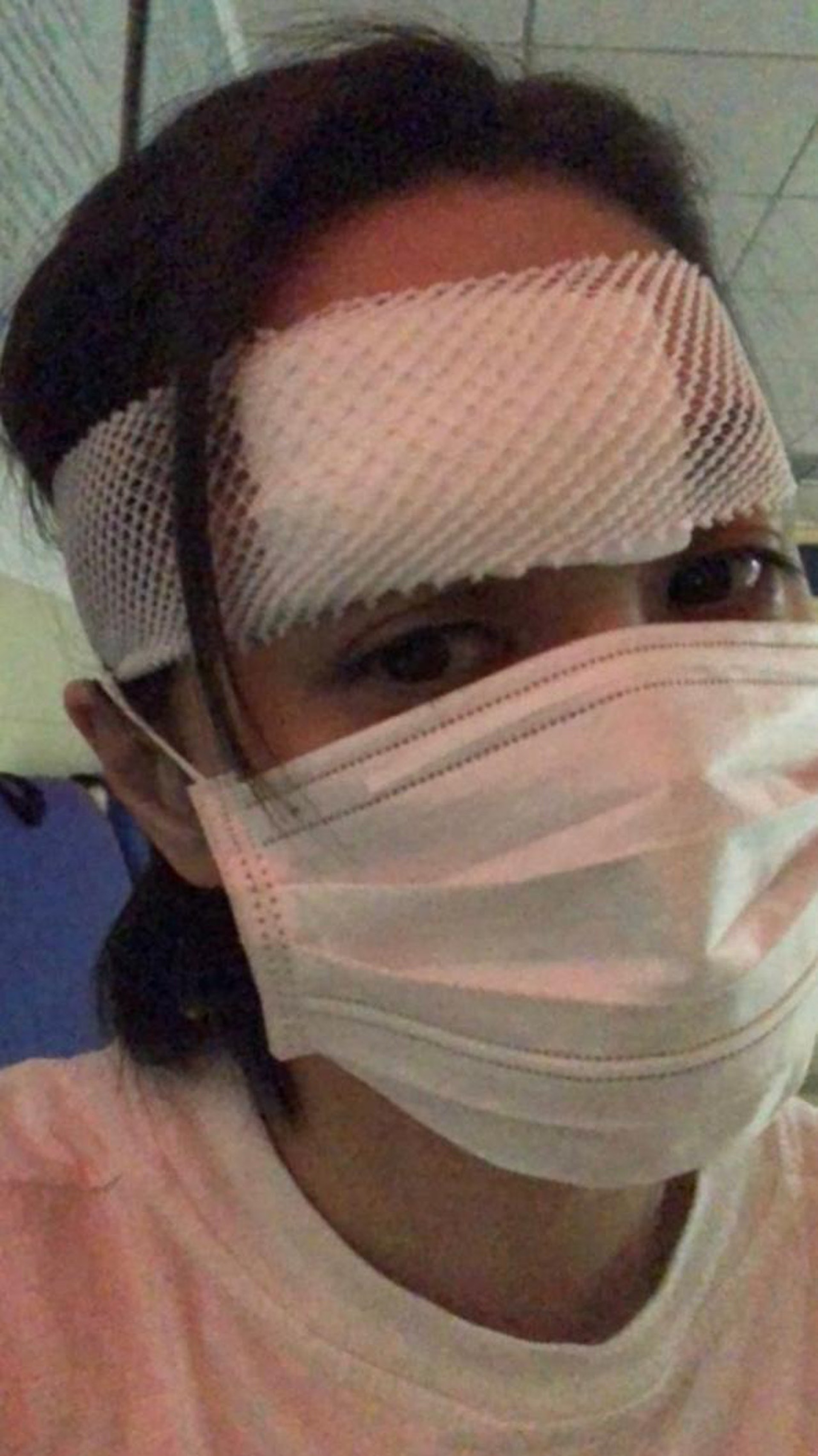 阿嬌頭部受傷。(英皇提供) 阿嬌頭部受傷。(英皇提供)