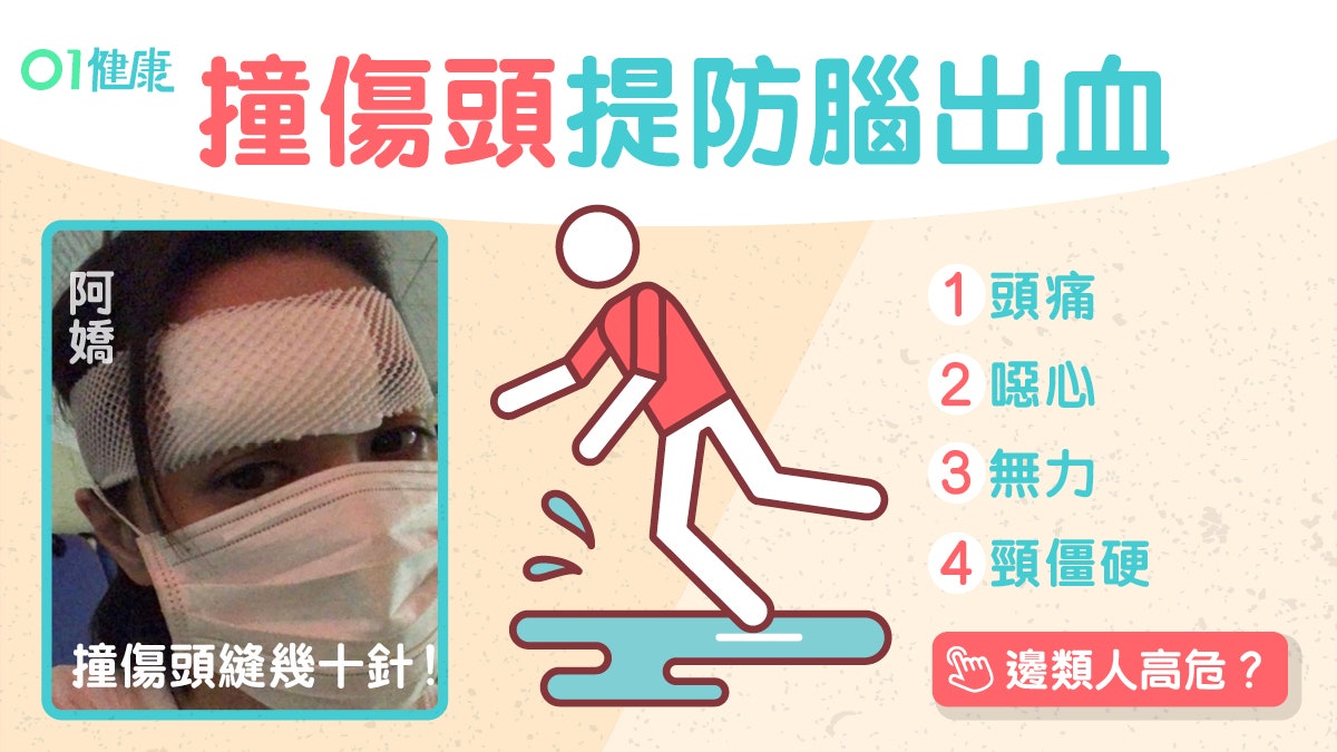 阿嬌受傷 頭重創6厘米傷口撞頭小心腦出血留意頸僵硬5大症狀 香港01 健康 阿嬌受傷 頭重創6厘米傷口撞頭小心腦出血留意頸僵硬5大症狀 香港01 健康