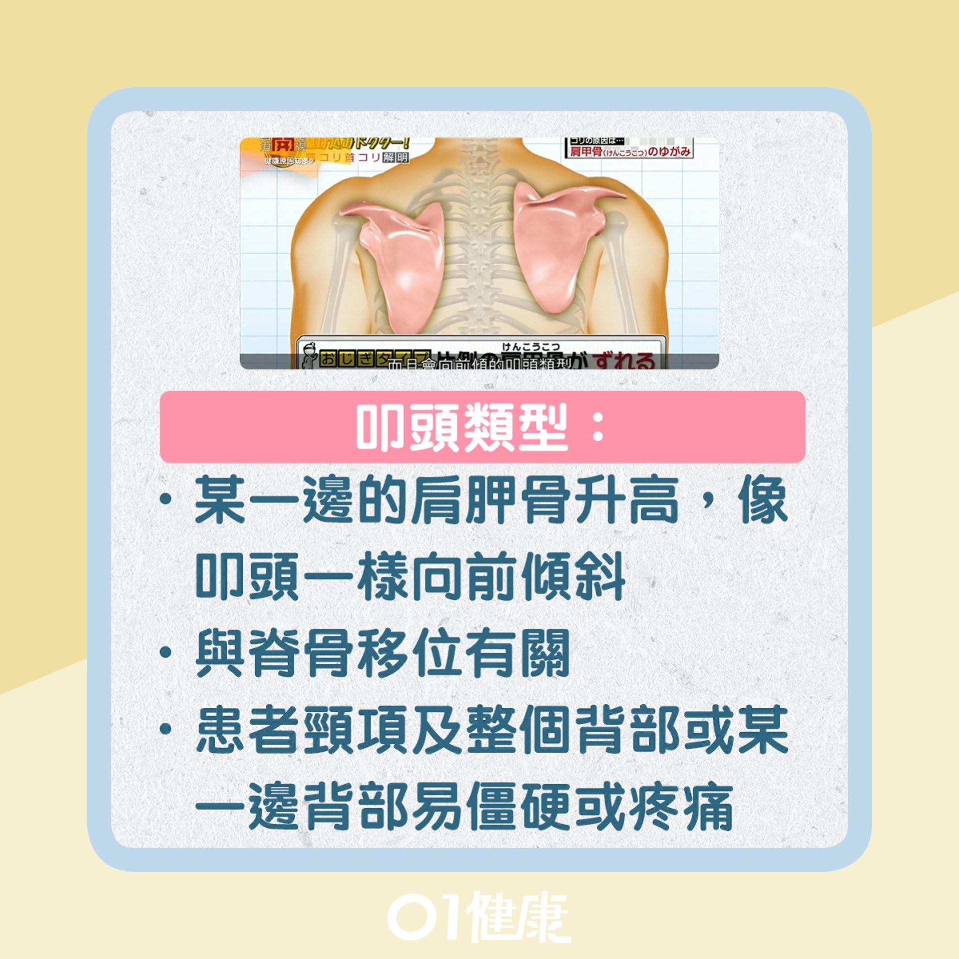 每日3分鐘 紓緩肩頸痛1條毛巾簡易動作30秒測試肩頸僵硬原因 醫師easy 每日3分鐘 紓緩肩頸痛1條毛巾簡易動作30秒測試肩頸僵硬原因 醫師easy