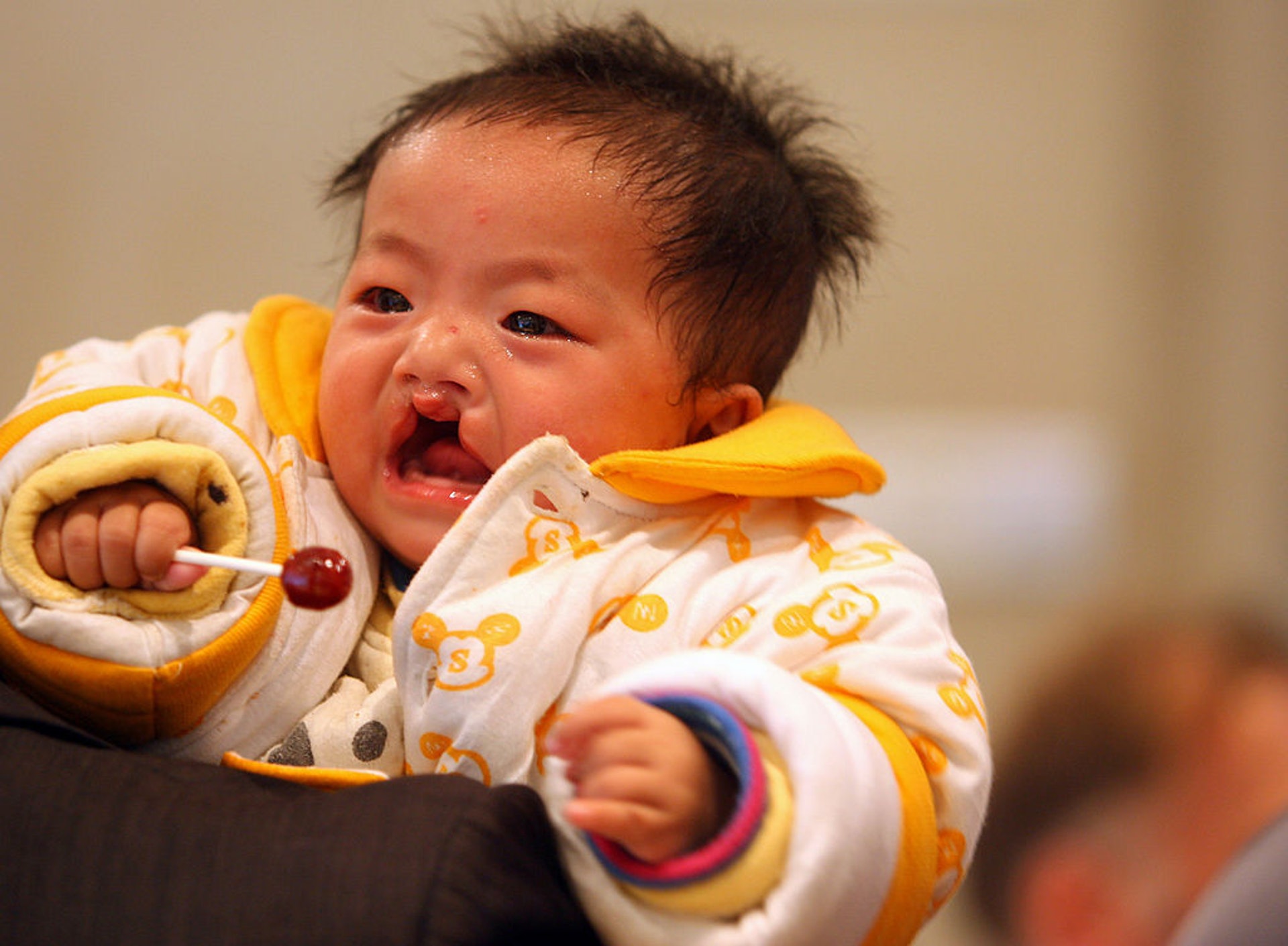據是次研究,產前發現唇顎裂嬰兒,有8成媽媽選擇繼續妊娠。(GettyImages) 據是次研究,產前發現唇顎裂嬰兒,有8成媽媽選擇繼續妊娠。(GettyImages)