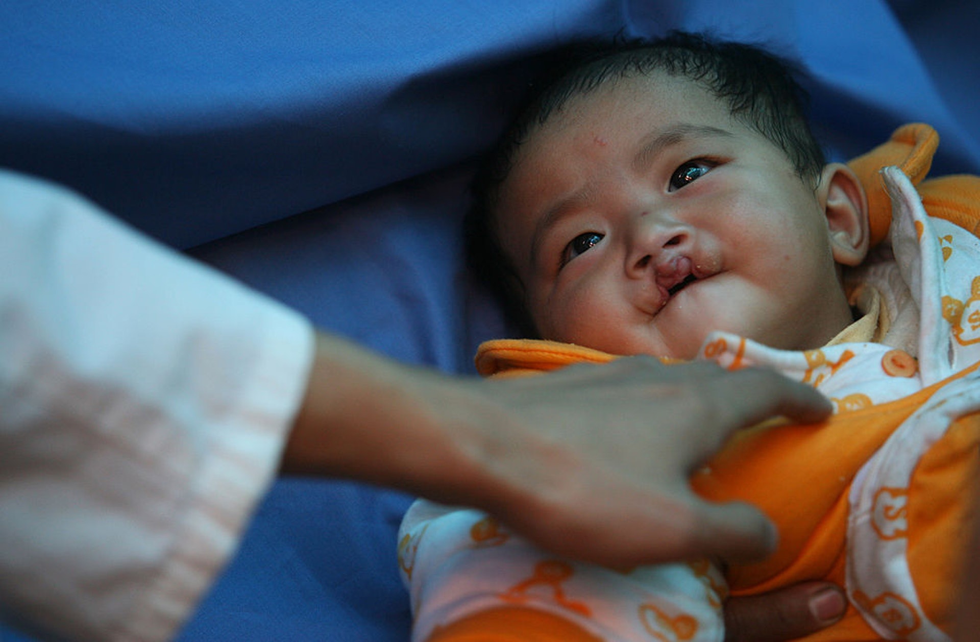 據是次研究,產前發現唇顎裂嬰兒,有8成媽媽選擇繼續妊娠。(GettyImages) 據是次研究,產前發現唇顎裂嬰兒,有8成媽媽選擇繼續妊娠。(GettyImages)
