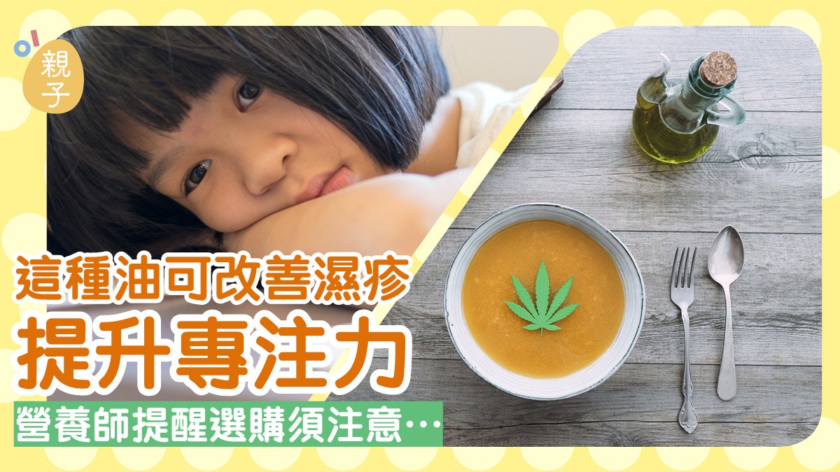 歐美熱捧食油可改善濕疹敏感 提升專注力 成分來自大麻家族? 歐美熱捧食油可改善濕疹敏感 提升專注力 成分來自大麻家族?