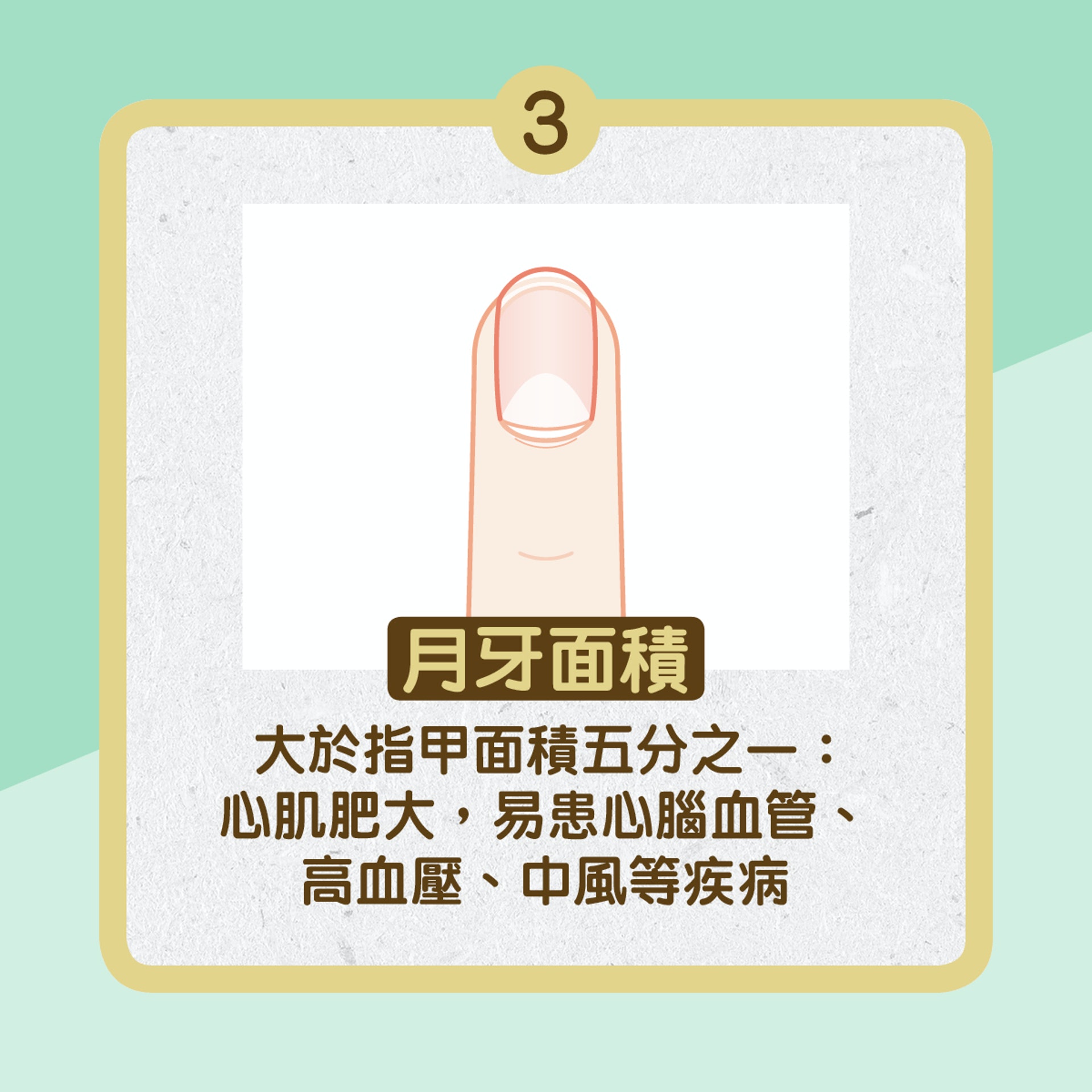 月牙大小反映健康(01製圖) 月牙大小反映健康(01製圖)