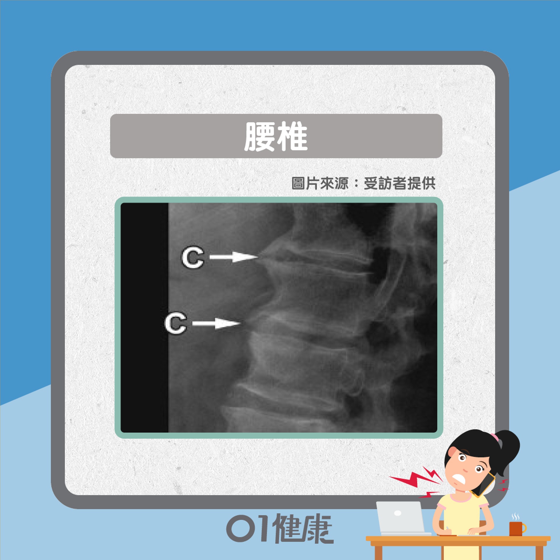 骨刺常見部位（01製圖）