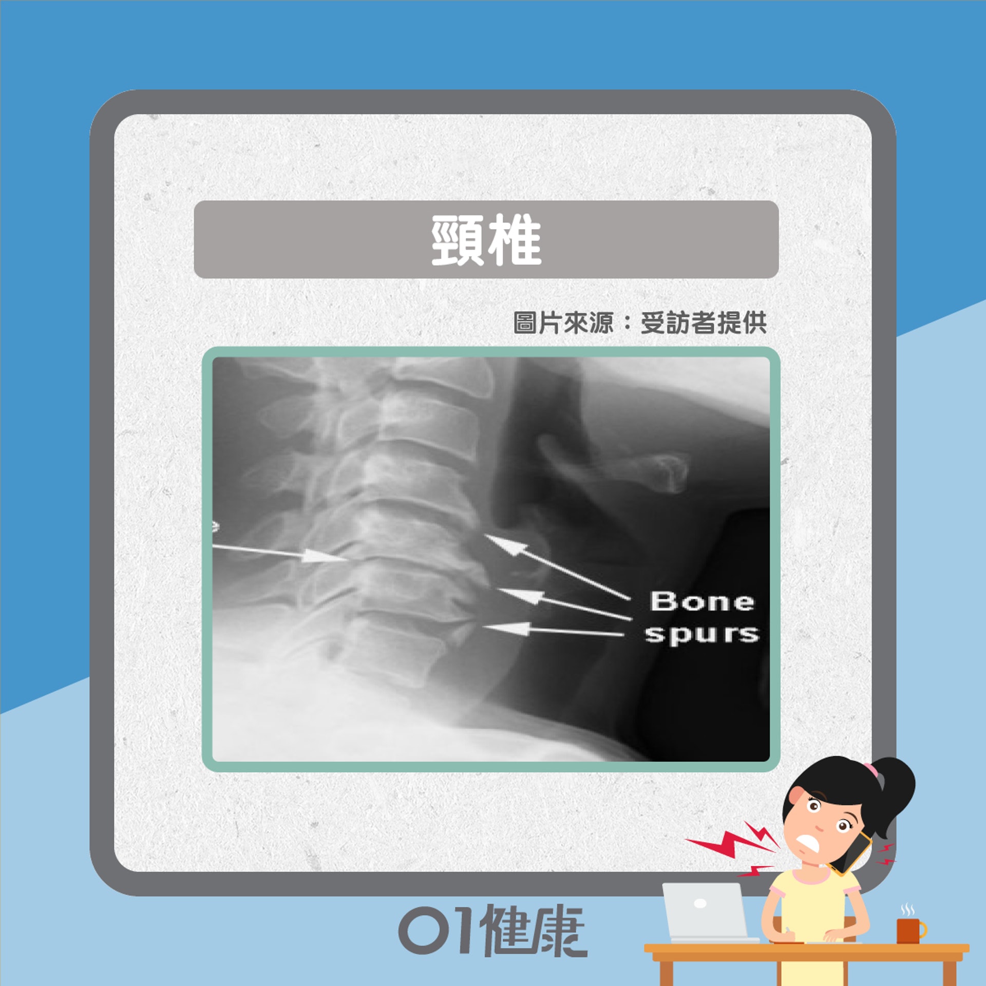 骨刺常見部位（01製圖）