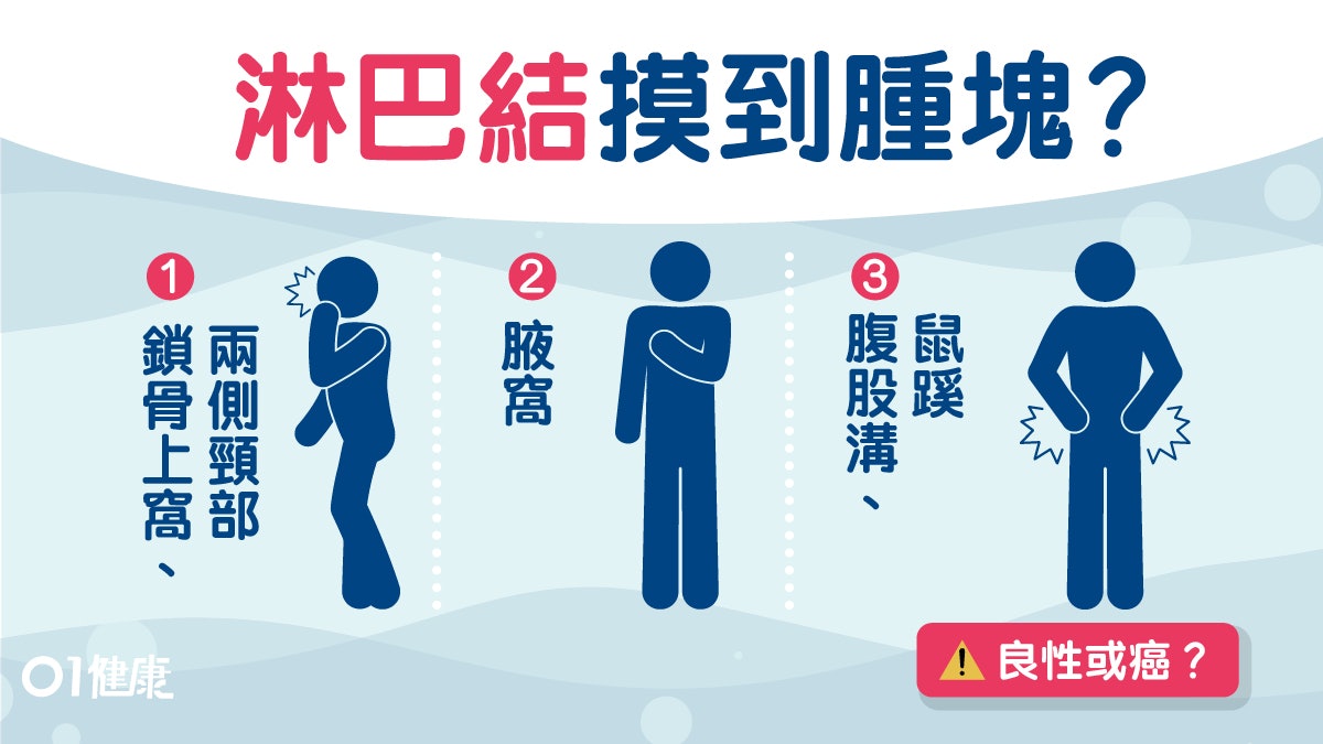 【癌症】摸到的硬塊多為良性腫瘤?自我檢測3大重點睇腫塊位置 【癌症】摸到的硬塊多為良性腫瘤?自我檢測3大重點睇腫塊位置