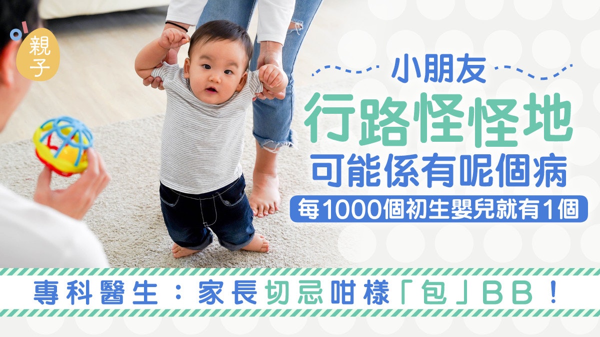 小朋友走路步姿奇怪或是髖關節發育不良 呢7類人屬於高危族群 小朋友走路步姿奇怪或是髖關節發育不良 呢7類人屬於高危族群
