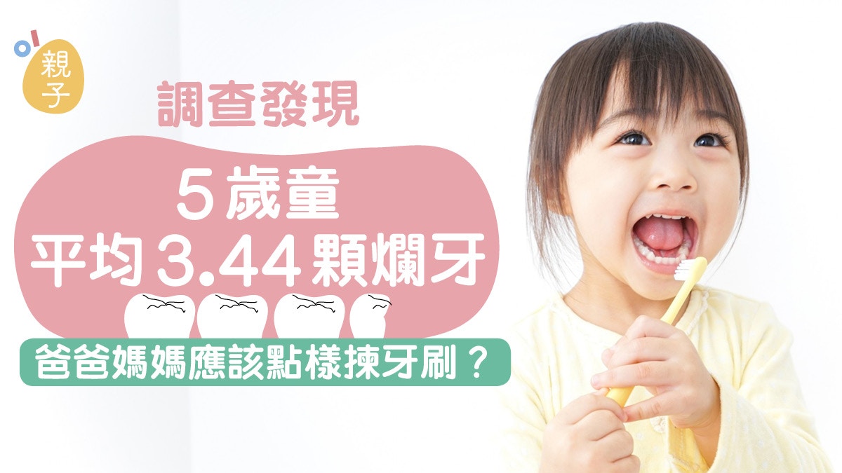 兒童蛀牙︱5歲童平均有超過3顆爛牙　必要知的7個刷牙及護牙貼士