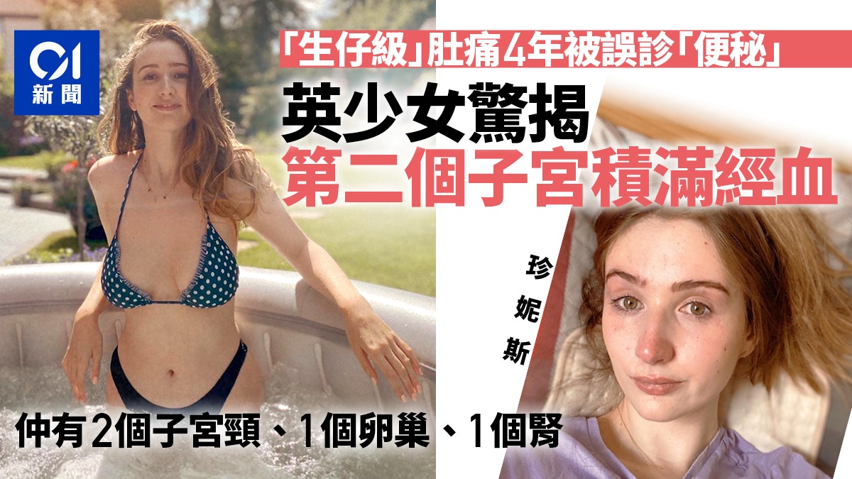 英國美少女腹痛多年被誤診為便秘　終發現有第二個子宮塞滿經血