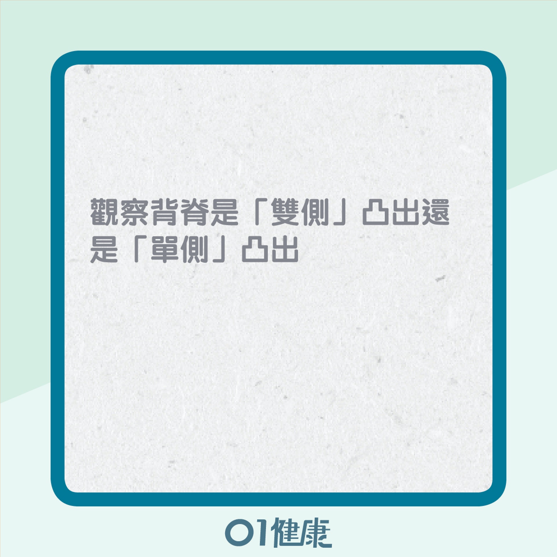自我檢測脊椎側彎(01製圖) 自我檢測脊椎側彎(01製圖)