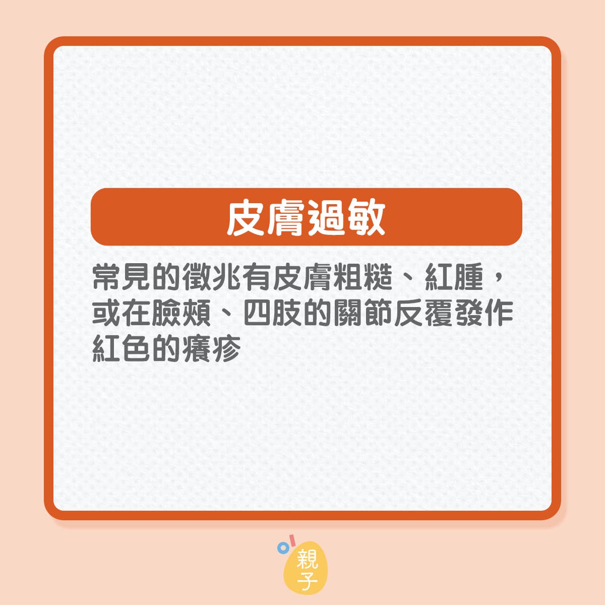 寶寶容易過敏的身體部位（01製圖）