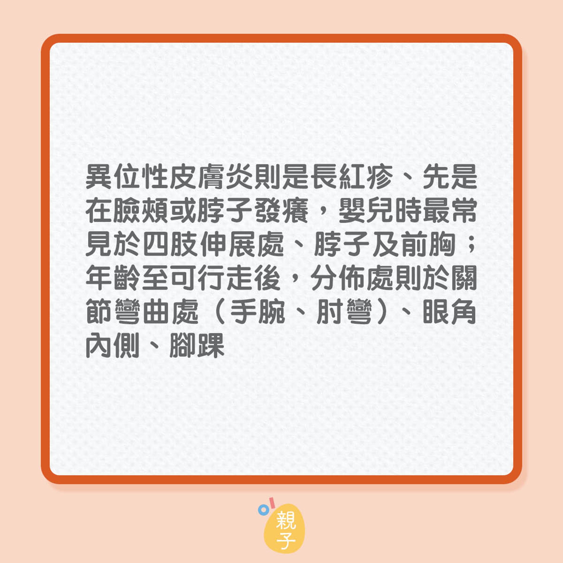 分辨過敏與其他疾病(01製圖) 分辨過敏與其他疾病(01製圖)
