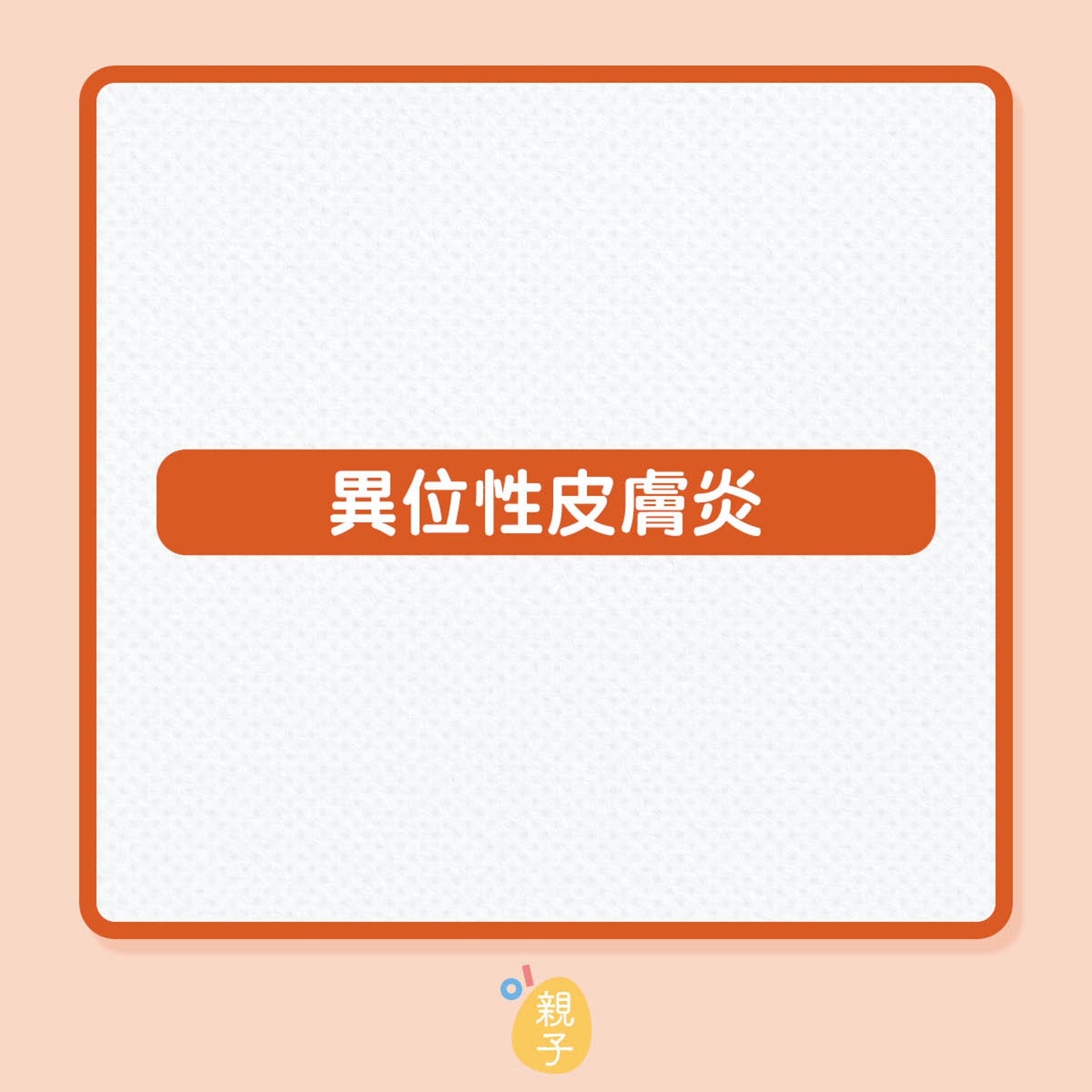 異位性皮膚炎和呼吸道過敏疾病的注意事項(01製圖) 異位性皮膚炎和呼吸道過敏疾病的注意事項(01製圖)