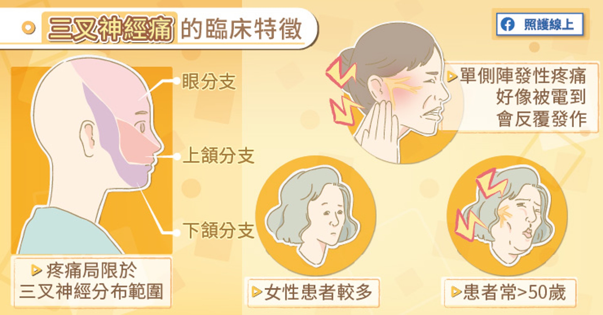 三叉神經痛的臨床特徵(照護線上授權使用) 三叉神經痛的臨床特徵(照護線上授權使用)