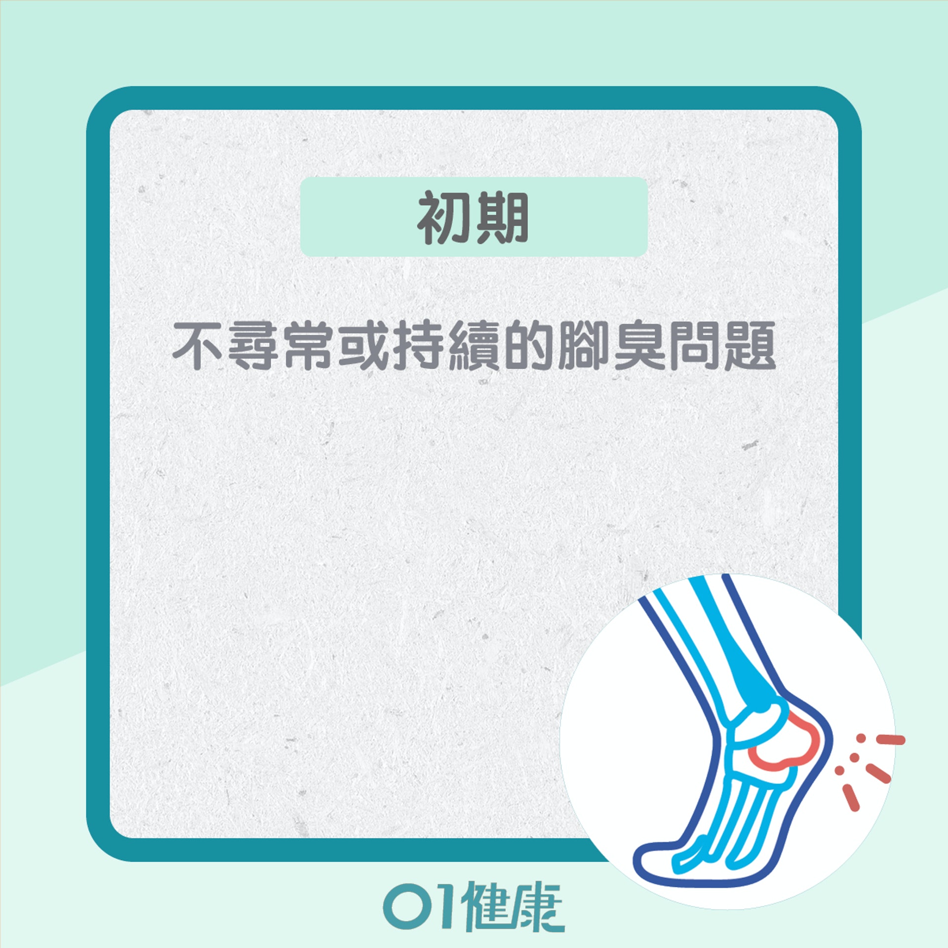 糖尿腳不同的階段的症狀(01製圖) 糖尿腳不同的階段的症狀(01製圖)