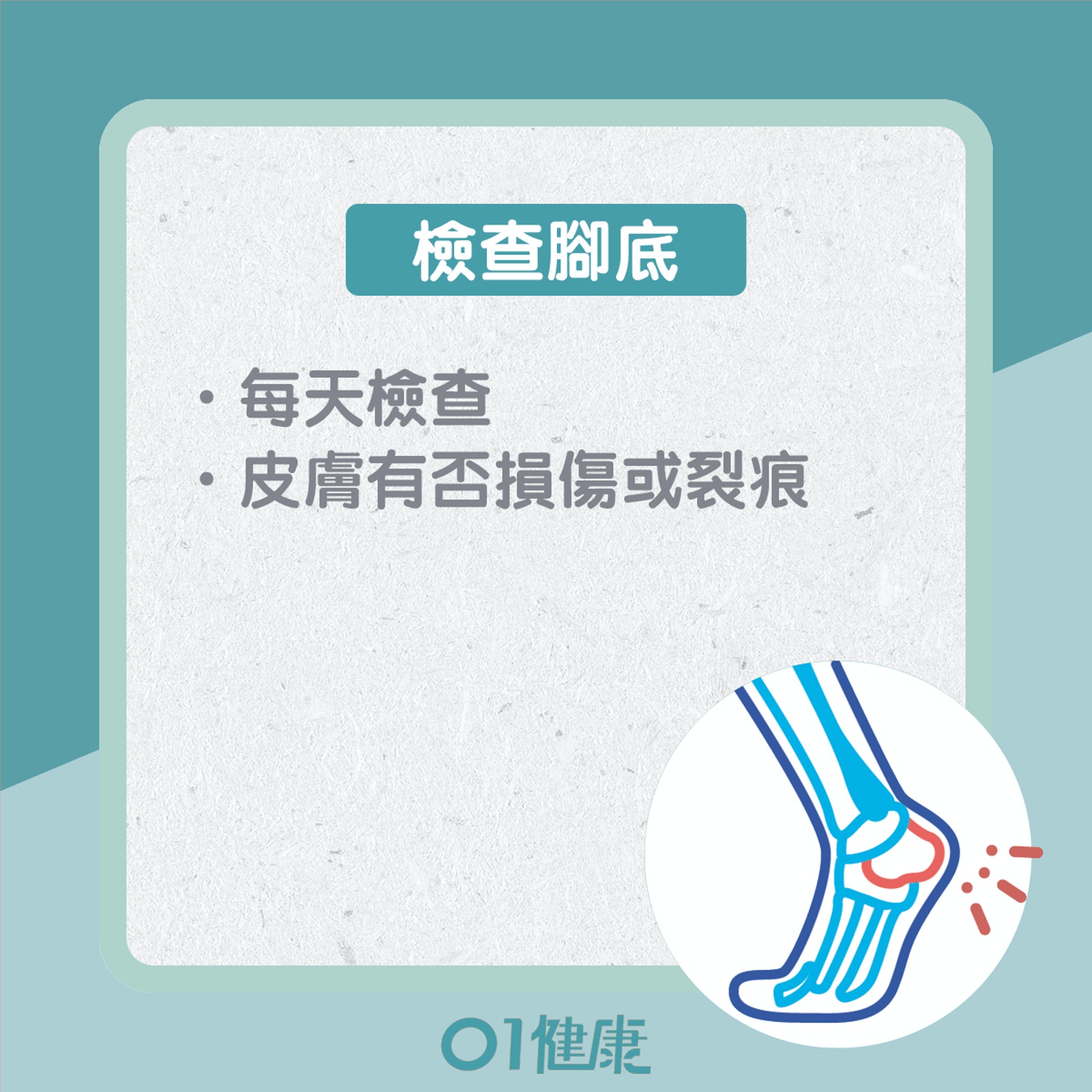 如何預防糖尿腳?(01製圖) 如何預防糖尿腳?(01製圖)