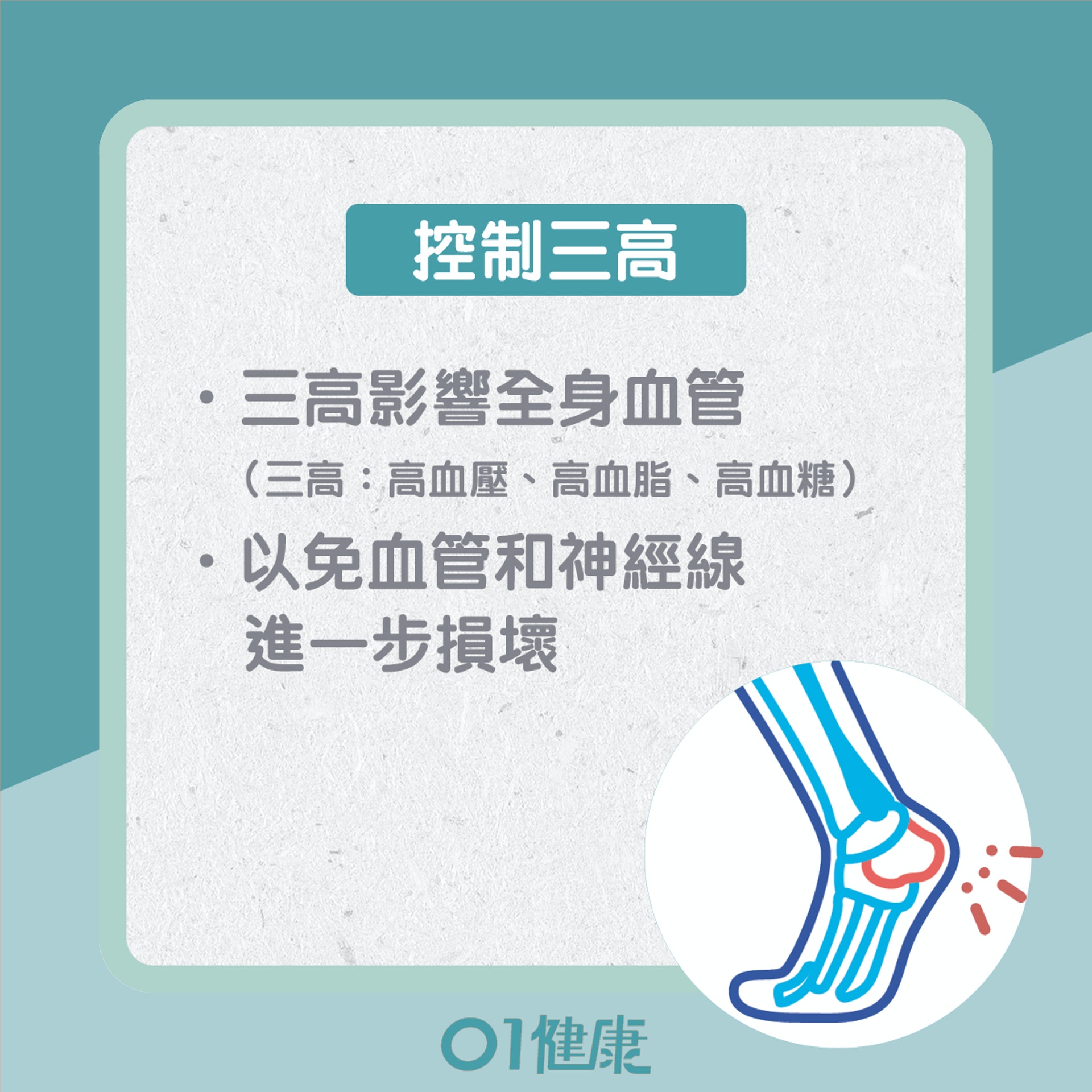 如何預防糖尿腳?(01製圖) 如何預防糖尿腳?(01製圖)