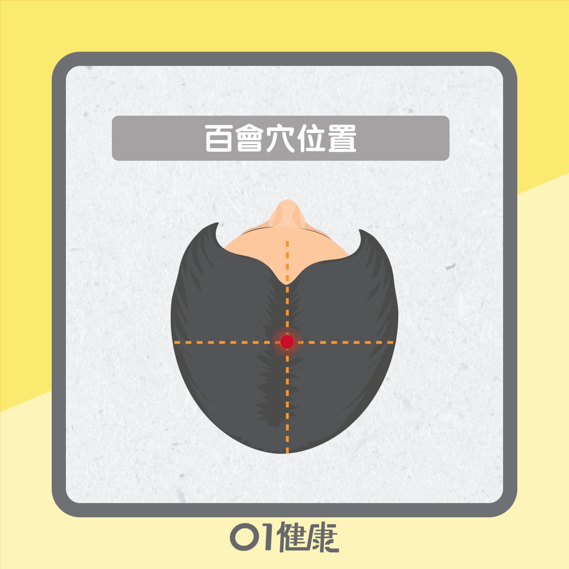 百會穴知多啲(01製圖) 百會穴知多啲(01製圖)