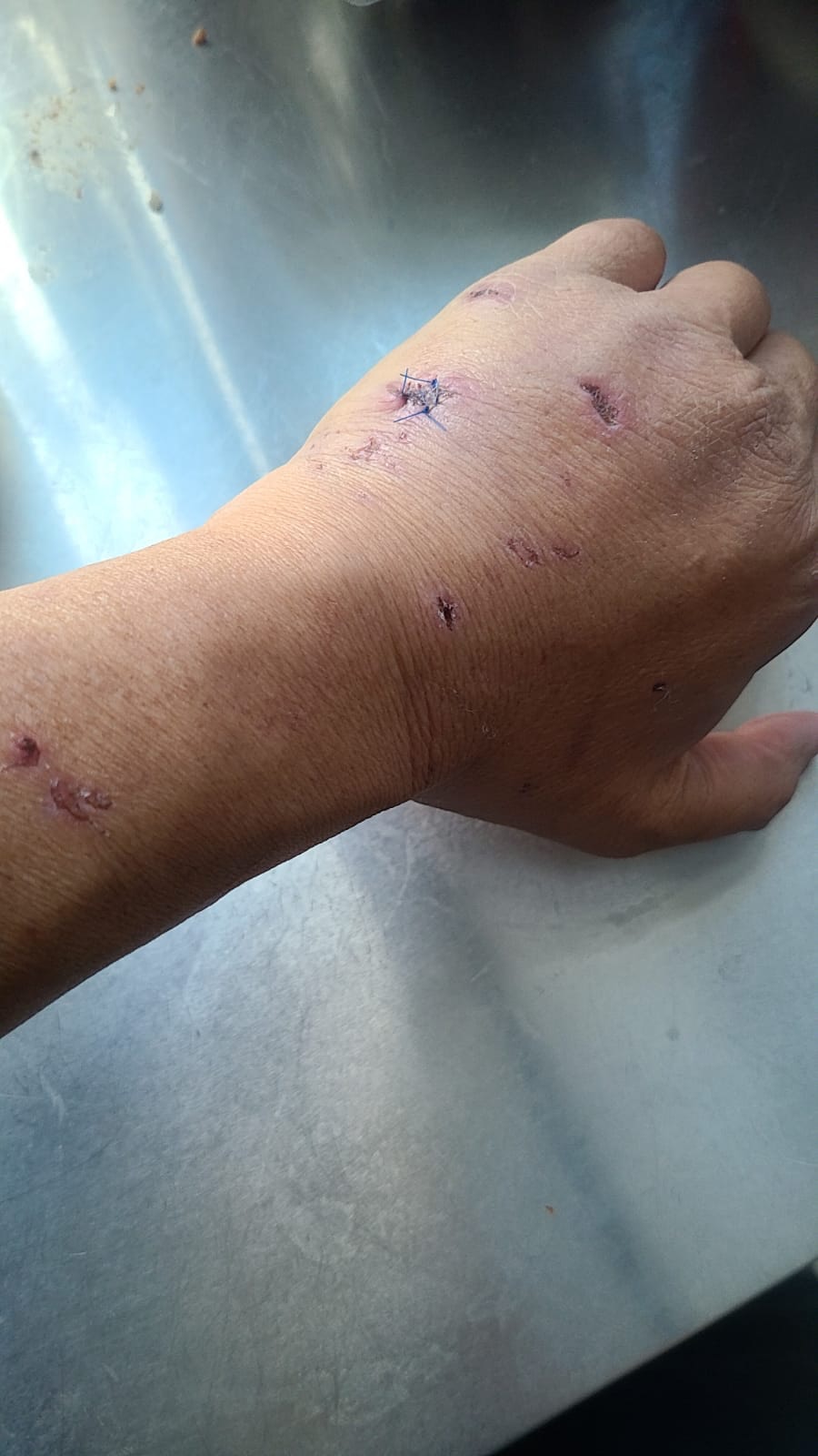 Kent 左手縫了6針。(Facebook@毛孩守護者) Kent 左手縫了6針。(Facebook@毛孩守護者)