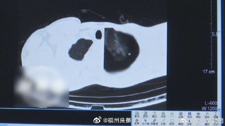 被猪队友连累打游戏连输男子真把 肺气炸了 万维读者网 被猪队友连累打游戏连输男子真把 肺气炸了 万维读者网