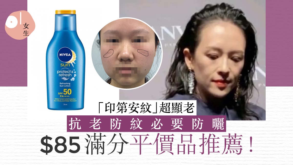 章子怡產後衰老現「印第安紋」如老十歲 專家揭抗衰老皺紋兩大法
