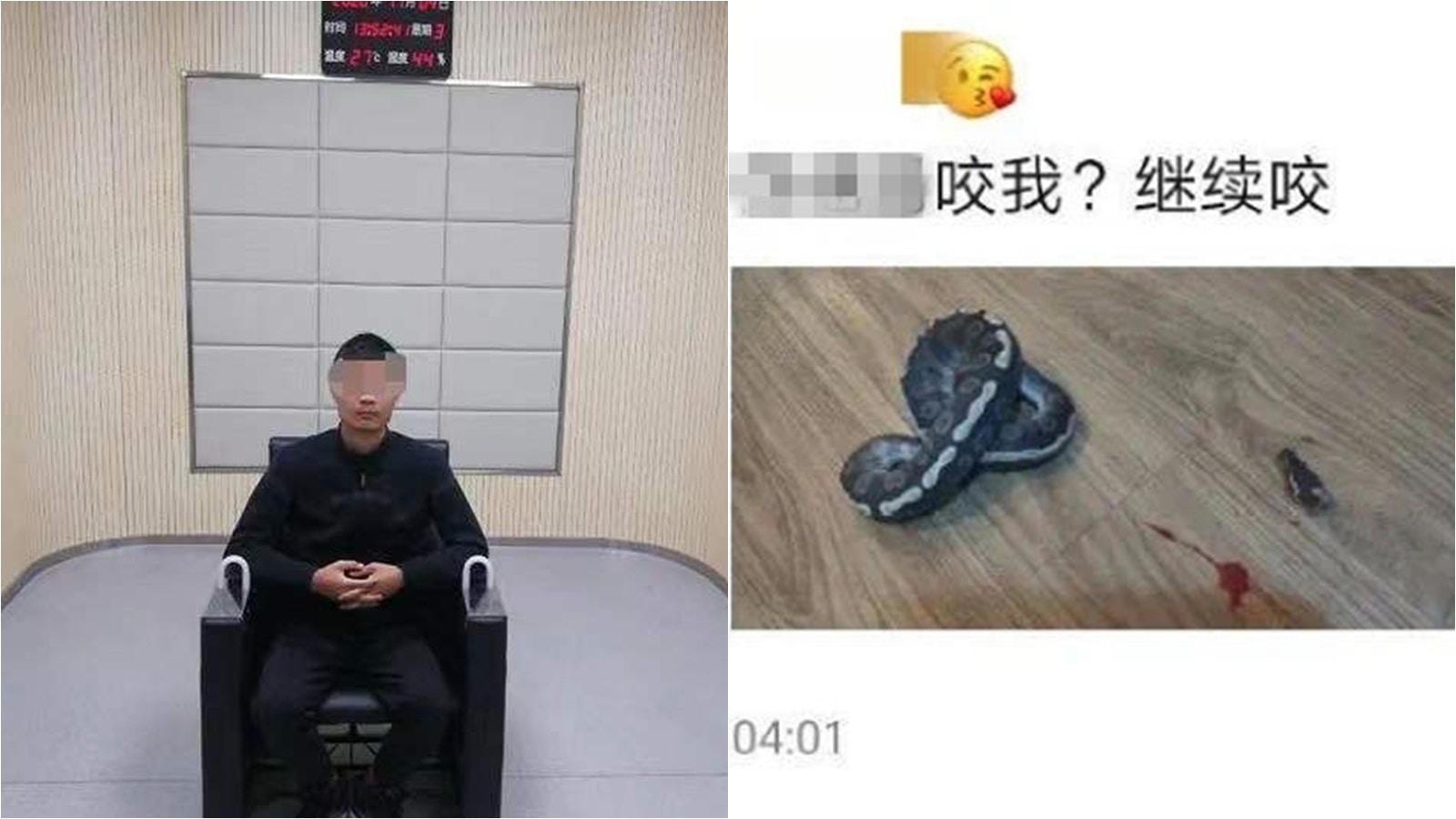 【殘忍】逗玩寵物球蟒時被咬傷　浙江男監生剪斷蛇頭兼晒相炫耀
