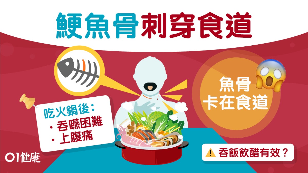 【鯁魚骨】火鍋後腹痛難吞嚥確診食道穿!異物鯁喉正確處理6步驟 【鯁魚骨】火鍋後腹痛難吞嚥確診食道穿!異物鯁喉正確處理6步驟