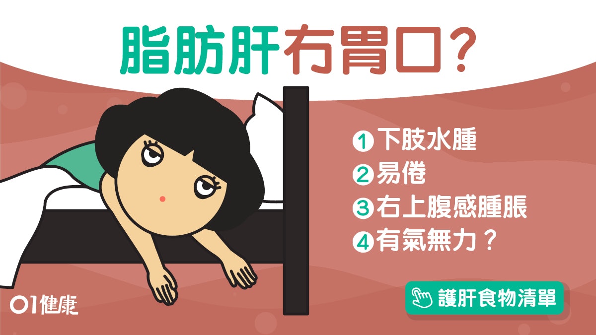 脂肪肝 致肝癌冇肝炎一樣中招 腳腫易倦冇力5症狀可能脂肪肝 香港01 健康 脂肪肝 致肝癌冇肝炎一樣中招 腳腫易倦冇力5症狀可能脂肪肝 香港01 健康