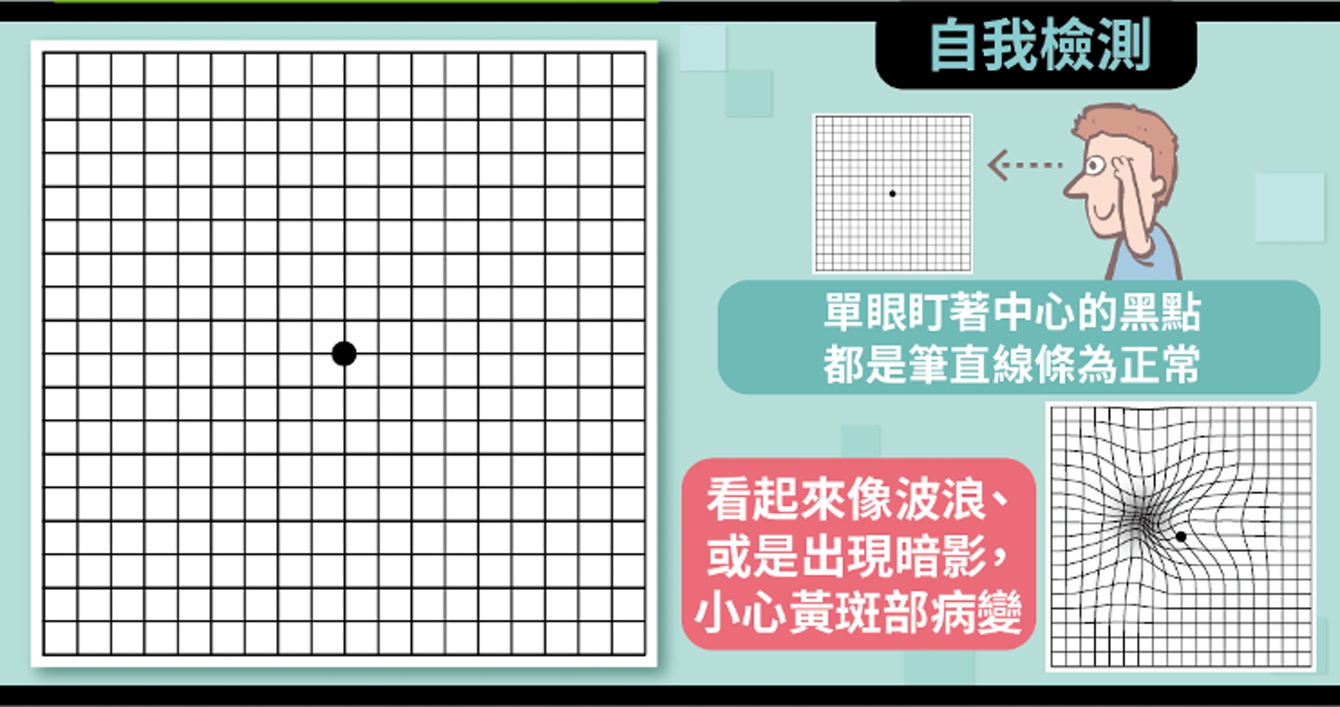 黃斑部病變小測試：檢測表（照護線上授權使用）