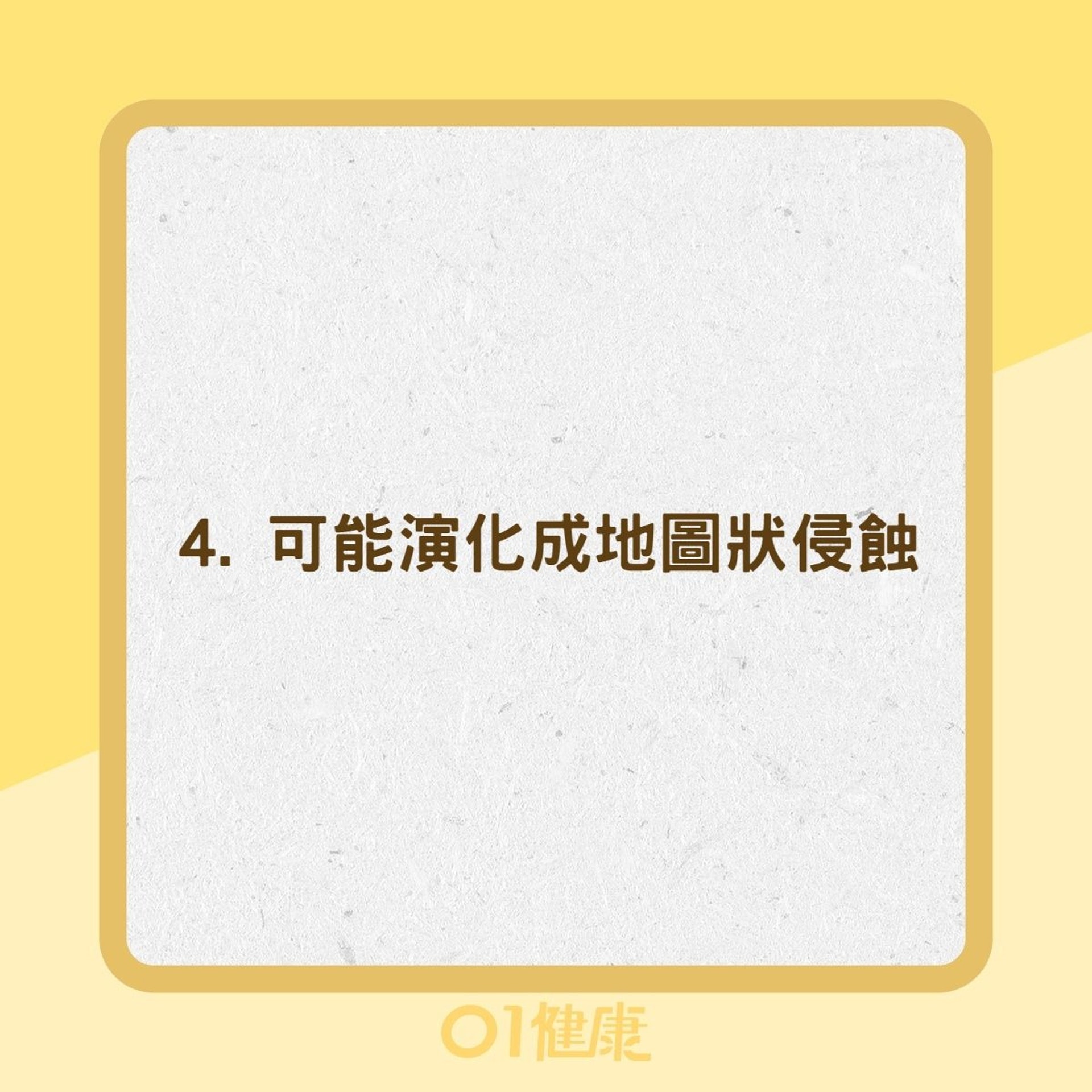 乾性年齡相關性黃斑部退化病變症狀(01製圖) 乾性年齡相關性黃斑部退化病變症狀(01製圖)