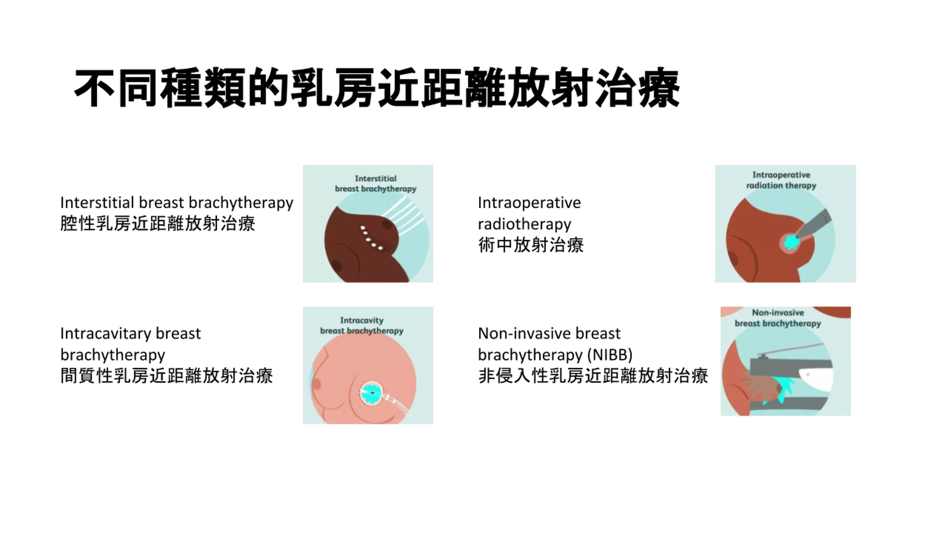 不同種類的乳房近距離治療。（圖片由張天怡醫生提供。）