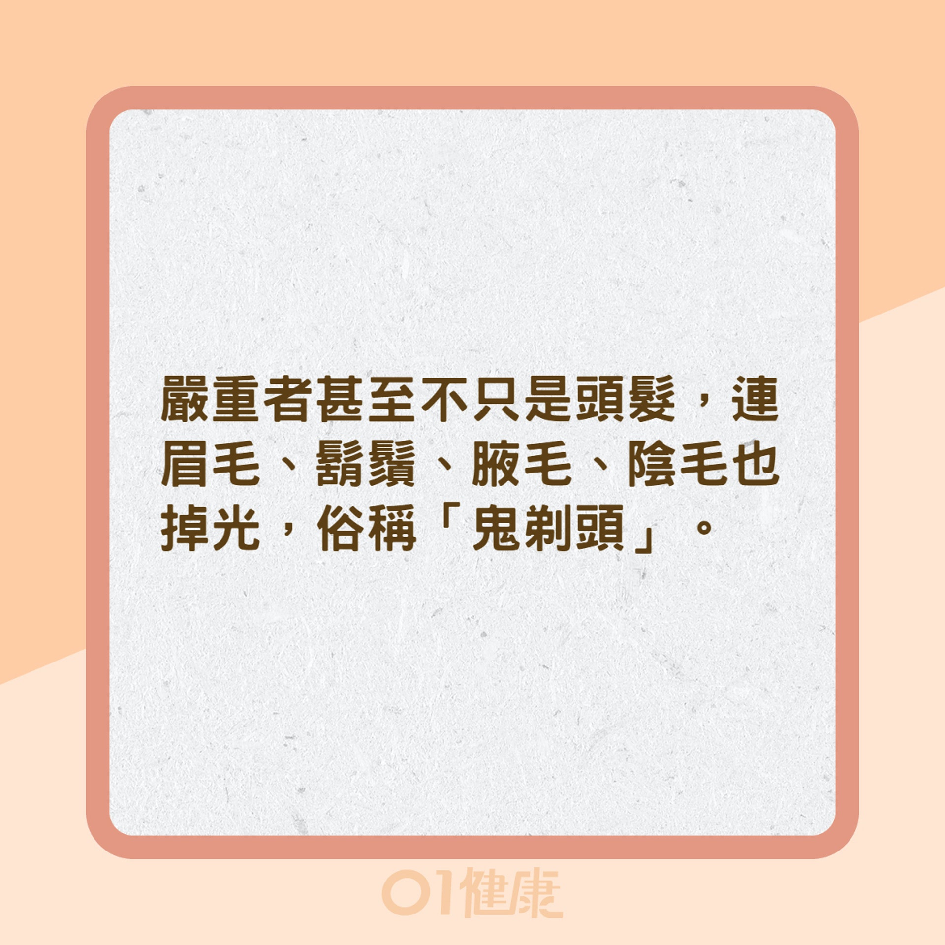 鬼剃頭是壓力大害的?(01製圖) 鬼剃頭是壓力大害的?(01製圖)