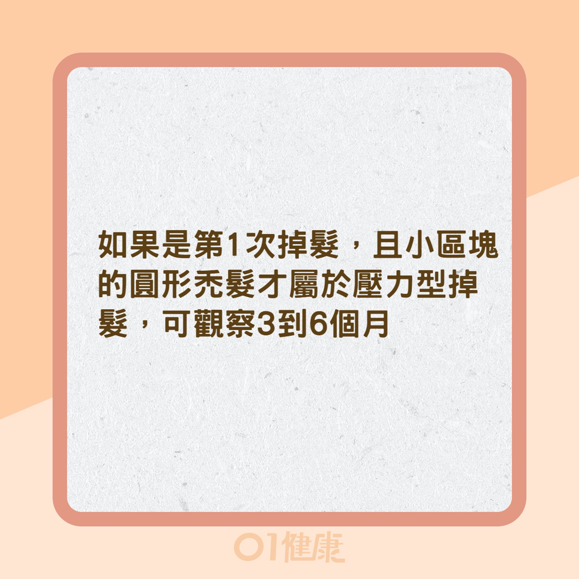 鬼剃頭是壓力大害的?(01製圖) 鬼剃頭是壓力大害的?(01製圖)