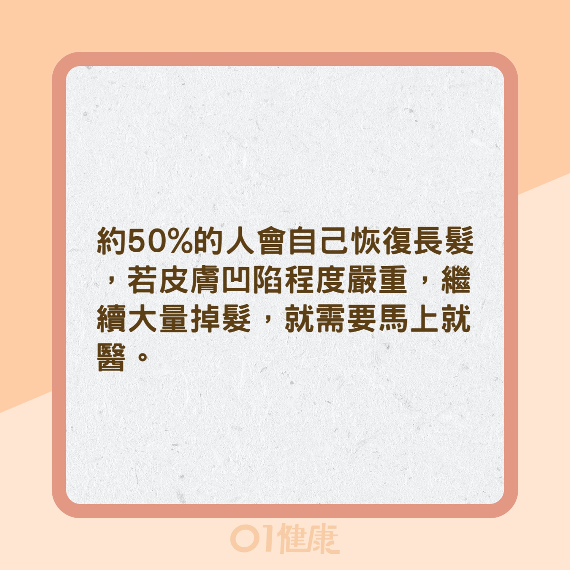 鬼剃頭是壓力大害的?(01製圖) 鬼剃頭是壓力大害的?(01製圖)
