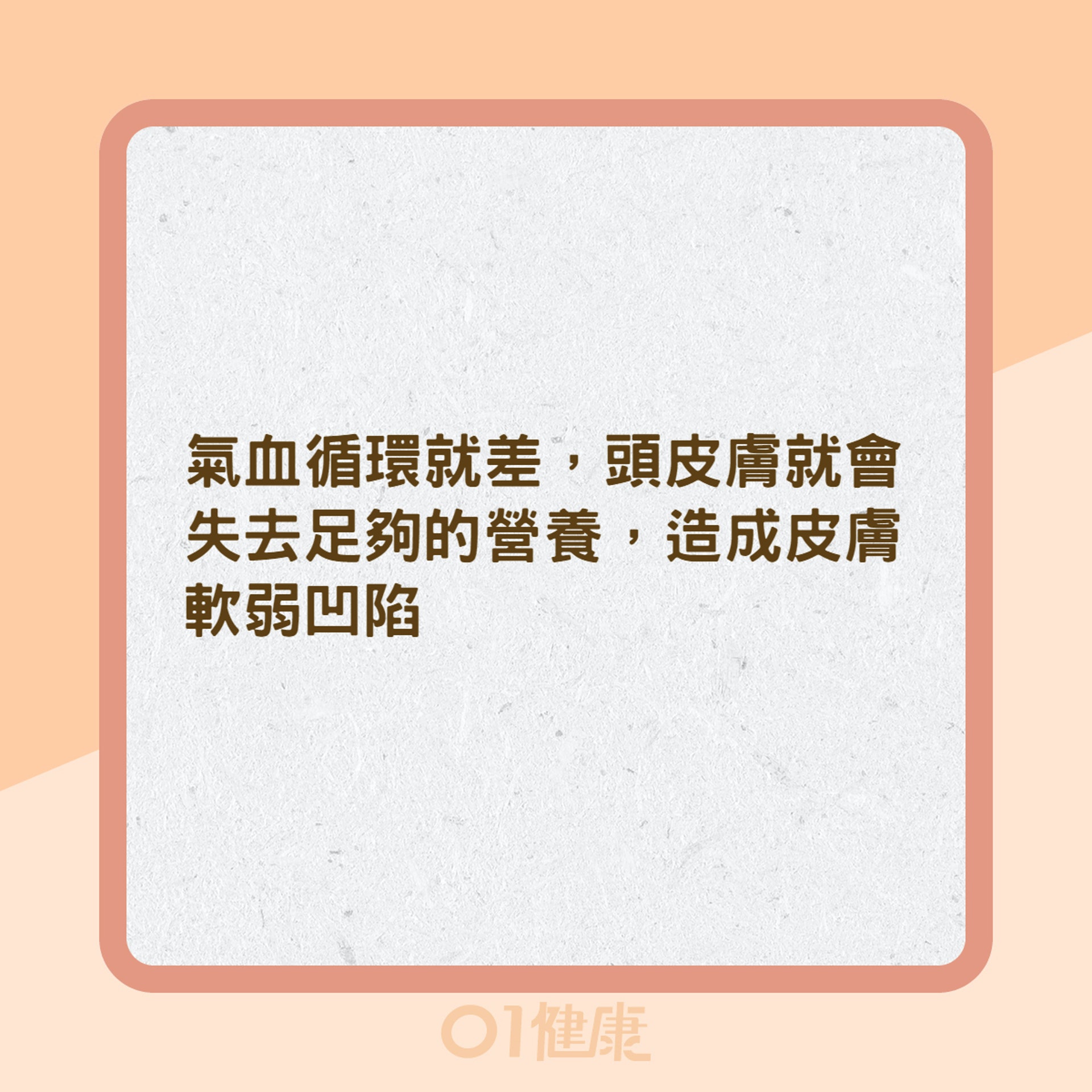 鬼剃頭是壓力大害的?(01製圖) 鬼剃頭是壓力大害的?(01製圖)