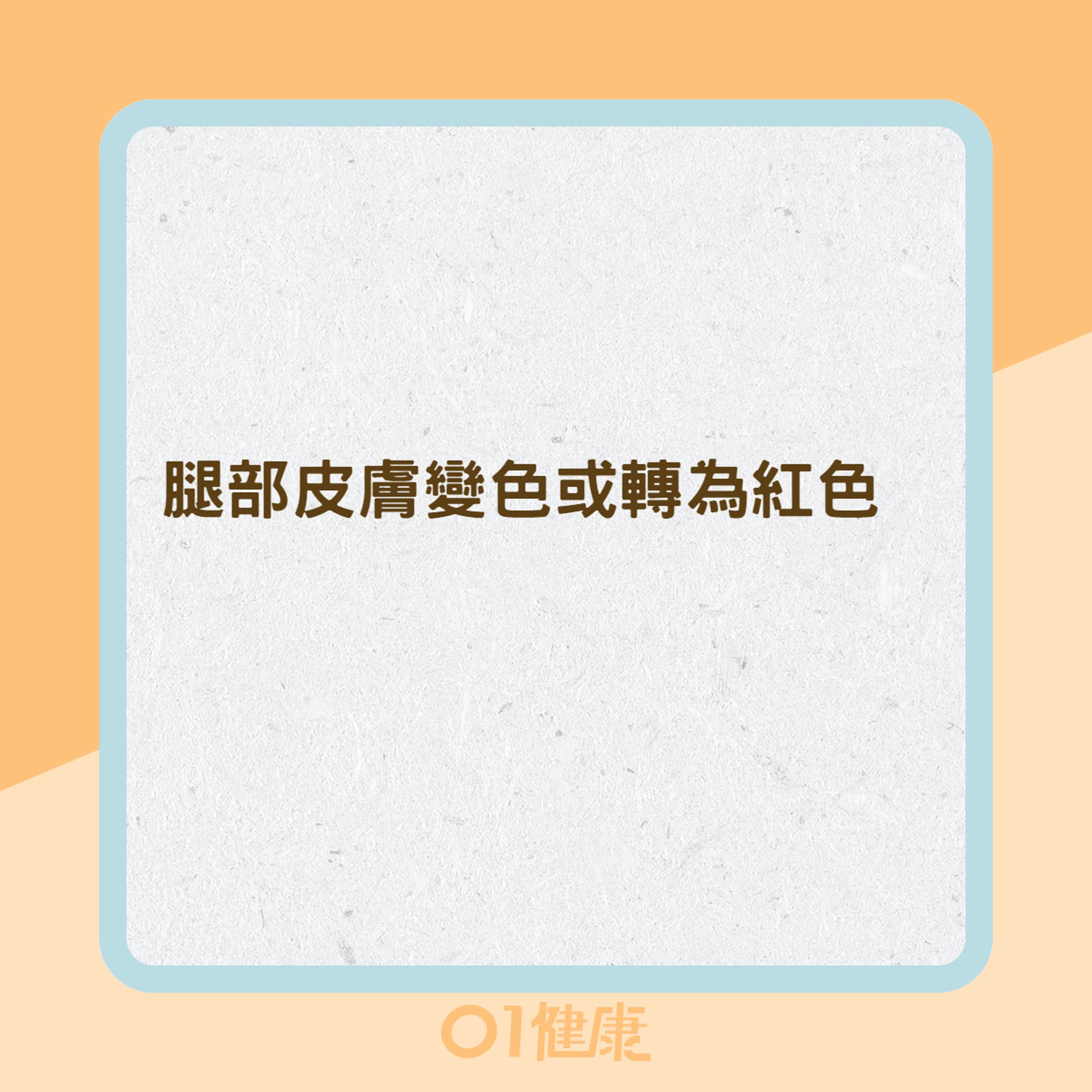 深層靜脈栓塞的症狀(01製圖) 深層靜脈栓塞的症狀(01製圖)