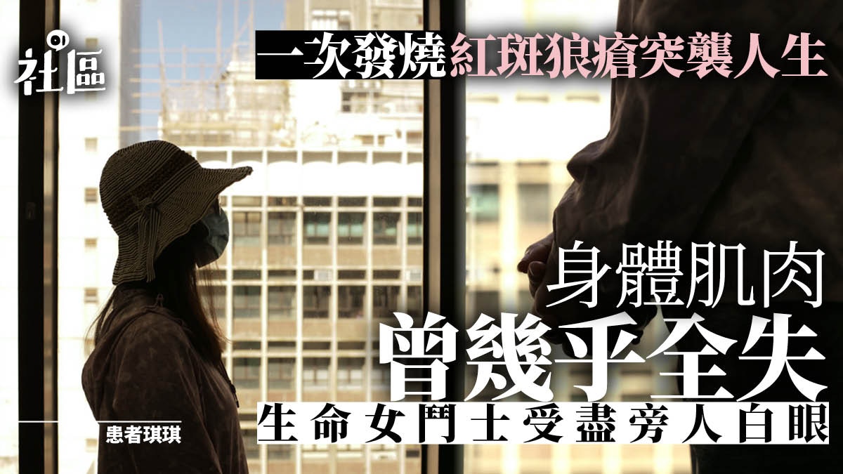 一次發燒顛覆人生　紅斑狼瘡患者從此「不見得光」　盼與病友同行