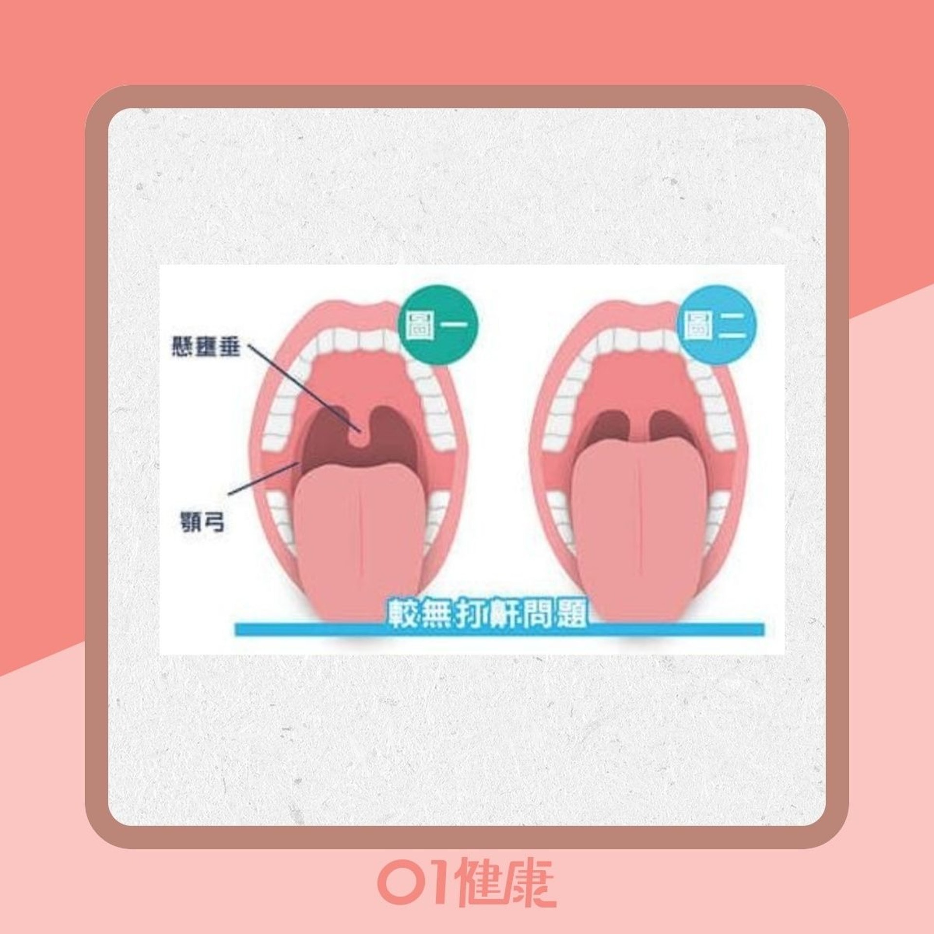 檢測自己打鼻鼾機率(Heho健康授權使用/01製圖) 檢測自己打鼻鼾機率(Heho健康授權使用/01製圖)