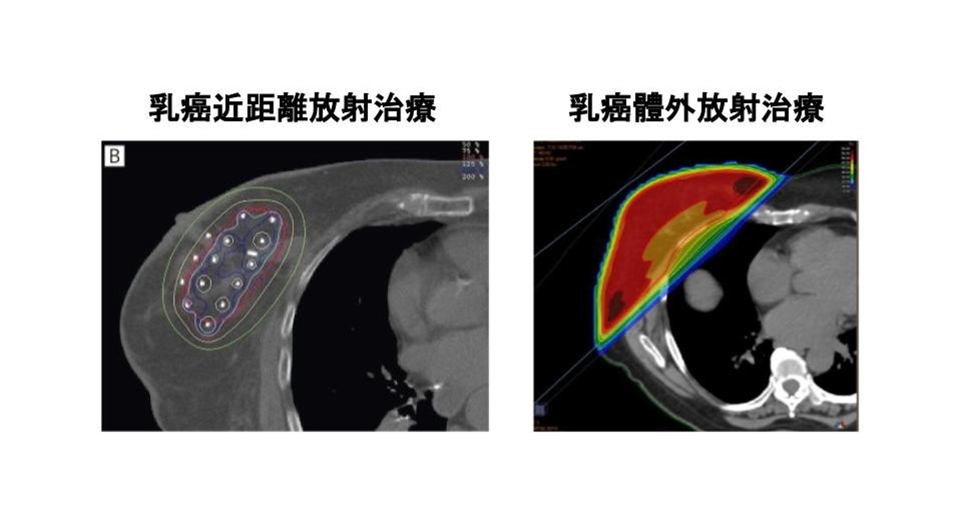 （圖片由張天怡醫生提供。）