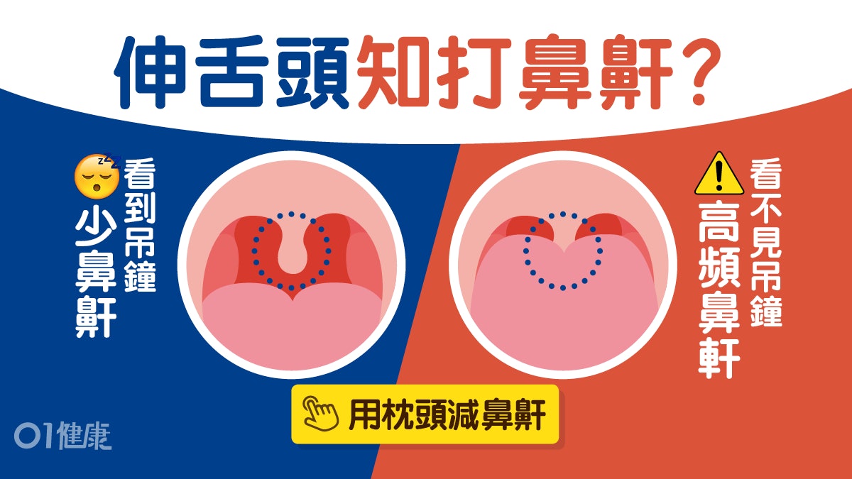 【鼻鼾】唱歌側睡5招改善鼻鼾 睇吊鐘就知你係咪睡眠窒息症高危 【鼻鼾】唱歌側睡5招改善鼻鼾 睇吊鐘就知你係咪睡眠窒息症高危