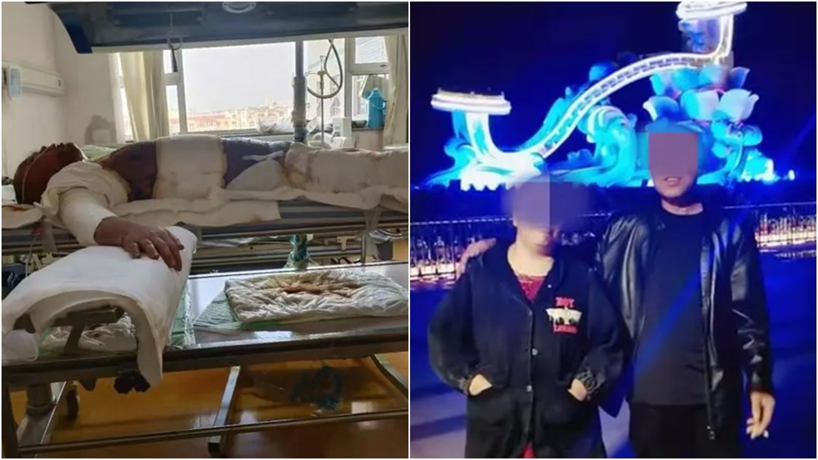 河北夫婦爭執引發家暴 妻子遭丈夫毆打兼淋汽油全身燒傷 河北夫婦爭執引發家暴 妻子遭丈夫毆打兼淋汽油全身燒傷