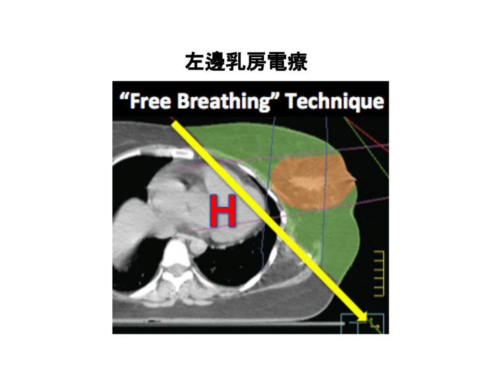 （圖片由張天怡醫生提供。）