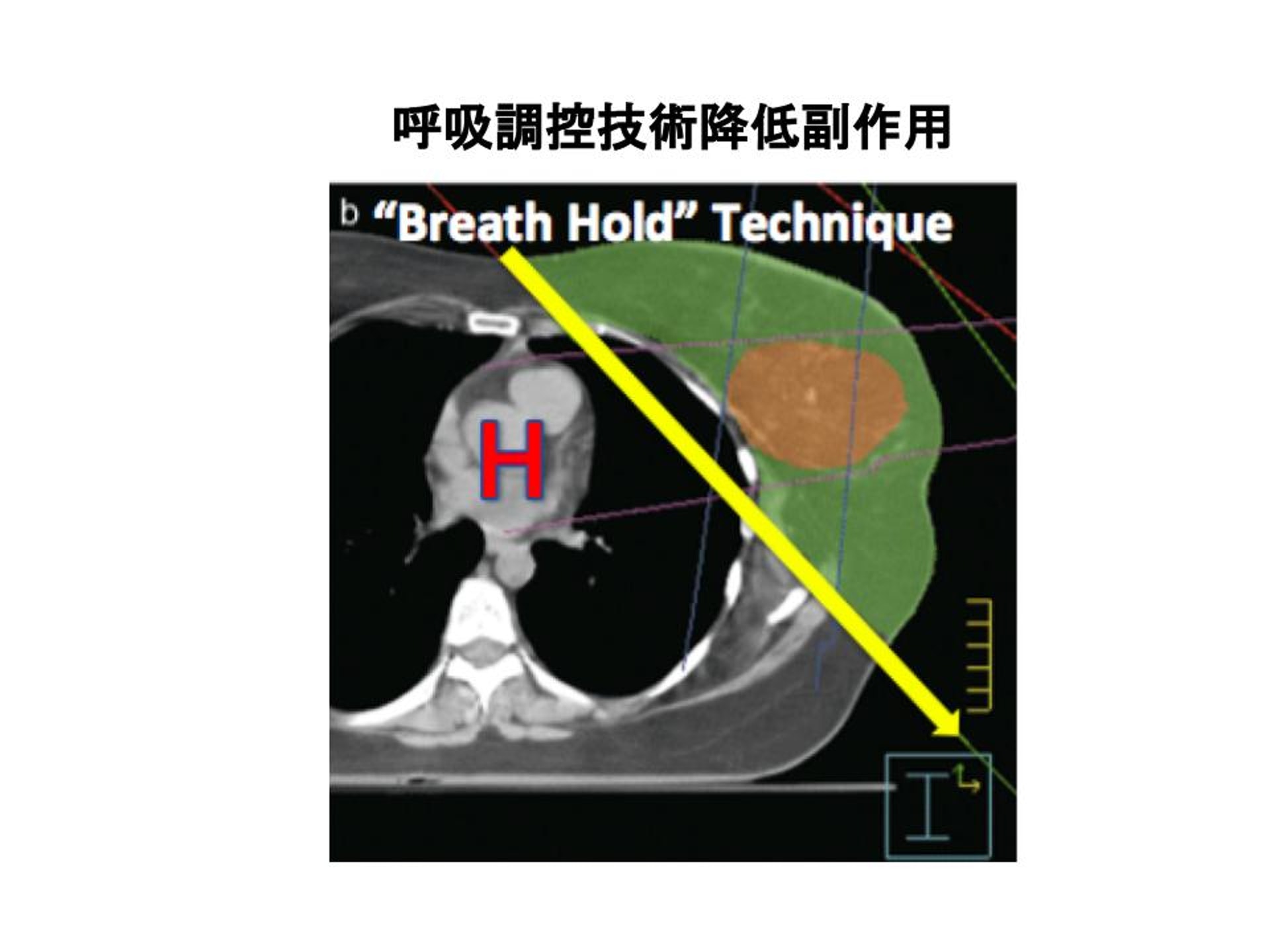 (圖片由張天怡醫生提供。) (圖片由張天怡醫生提供。)