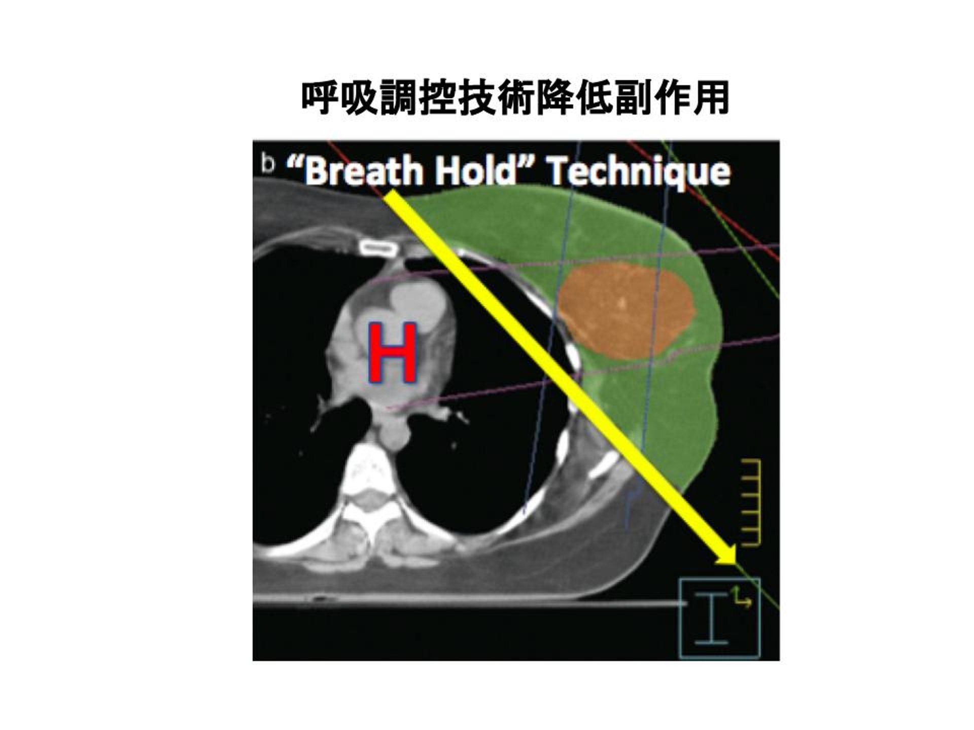 （圖片由張天怡醫生提供。）